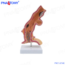 PNT-0748 Oesophagus pathology model esophageal anatomy